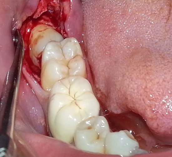 OPG X-Ray Service in Paldi