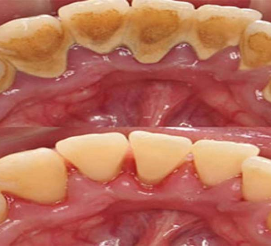 Dental Clinic in Paldi