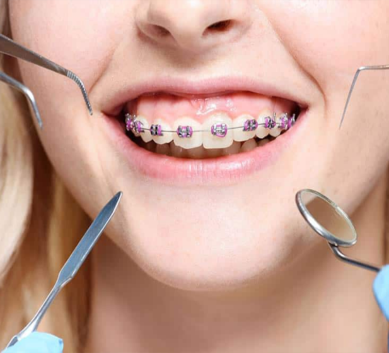 Surgical Extraction Service in Paldi